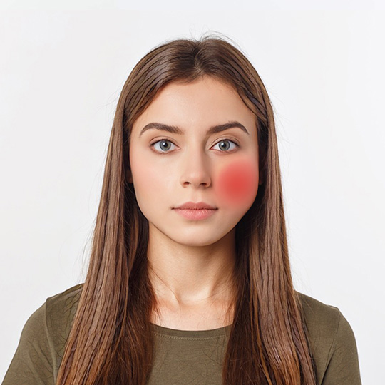 Обратитесь к врачу, если после удаления зуба отёк долго не спадает Отёк после удаления зуба