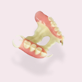 Протез верхней челюсти на 4 имплантатах модель установки протеза методом all-on-4