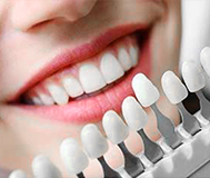 Подбор подходящего оттенка керамических виниров фото керамических виниров различных оттенков