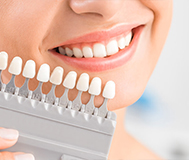 Люминиры в сравнении с настоящими зубами цветовая палитра виниров из фарфора