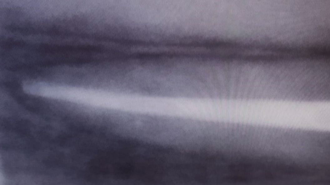 Снимок после лечения пульпита переднего зуба